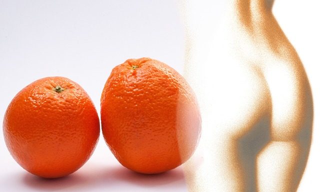 Jak odróżnić cellulit wodny od tłuszczowego?