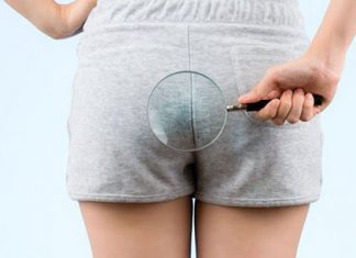 Problem z hemoroidami